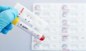 Ręka w niebieskiej rękawiczce trzyma probówkę z oznaczeniem "H. pylori: +" i test kasetkowy z dwoma paskami, wskazującymi pozytywny wynik helicobacter pylori badanie.