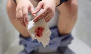 Dłoń trzyma papier toaletowy z widoczną jasną krwią w stolcu.