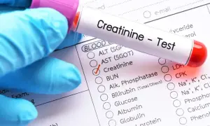 Rękawiczka medyczna trzyma probówkę z krwią do badania kreatyniny w surowicy. Zaznaczono pole "Creatinine" na formularzu.