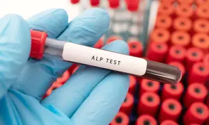 Rękawiczka w niebieskiej rękawiczce trzyma probówkę z napisem "ALP TEST". W tle widać stojak z czerwonymi probówkami. Dowiedz się, jak obniżyć fosfataza zasadowa.