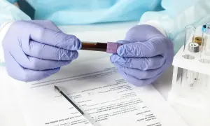 Ręce w rękawiczkach trzymają probówkę z krwią. Wyniki badań wskazują na eozynofile niskie.
