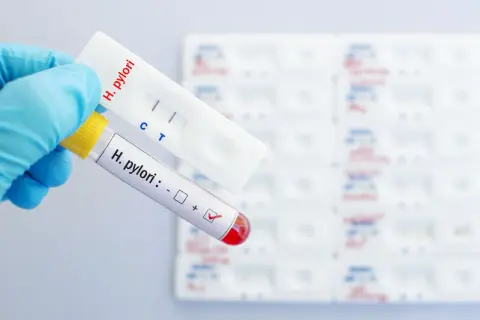 Ręka w niebieskiej rękawiczce trzyma probówkę z oznaczeniem "H. pylori: +" i test kasetkowy z dwoma paskami, wskazującymi pozytywny wynik helicobacter pylori badanie.