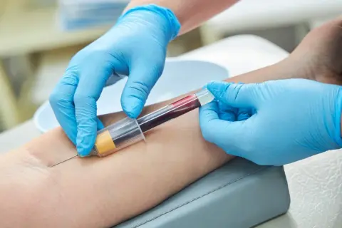 Pobieranie krwi do badań, które pomogą ocenić, jak szybko obniżyć próby wątrobowe.