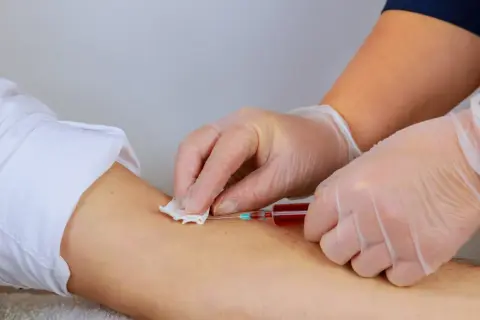 Pobieranie krwi do badania, które może pomóc znaleźć szybki sposób na podniesienie hemoglobiny.