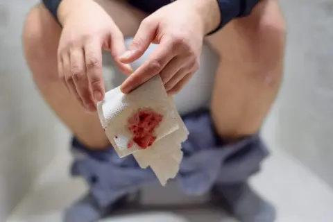 Dłoń trzyma papier toaletowy z widoczną jasną krwią w stolcu.