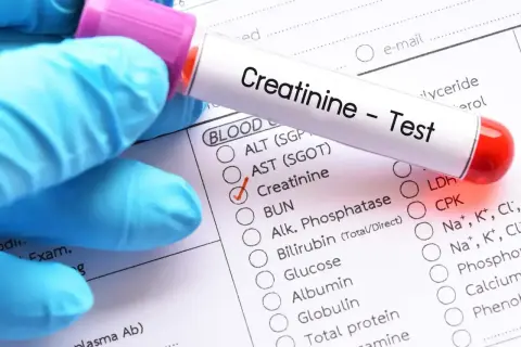 Rękawiczka medyczna trzyma probówkę z krwią do badania kreatyniny w surowicy. Zaznaczono pole "Creatinine" na formularzu.
