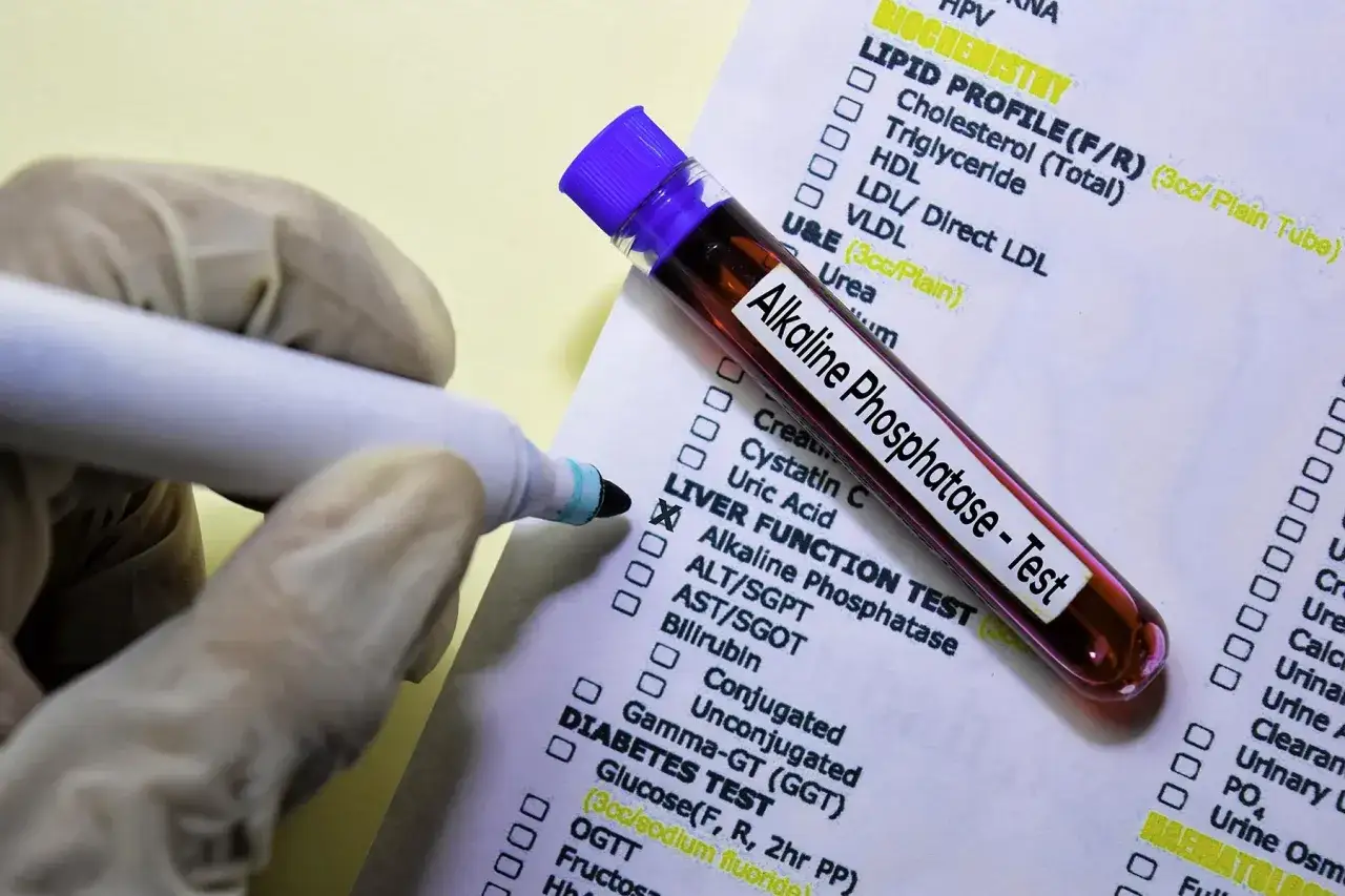 Ręka w rękawiczce zaznacza krzyżykiem test na fosfatazę zasadową na liście badań. Obok leży probówka z krwią.