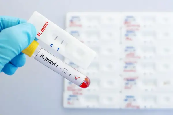 Ręka w niebieskiej rękawiczce trzyma probówkę z oznaczeniem "H. pylori: +" i test kasetkowy z dwoma paskami, wskazującymi pozytywny wynik helicobacter pylori badanie.
