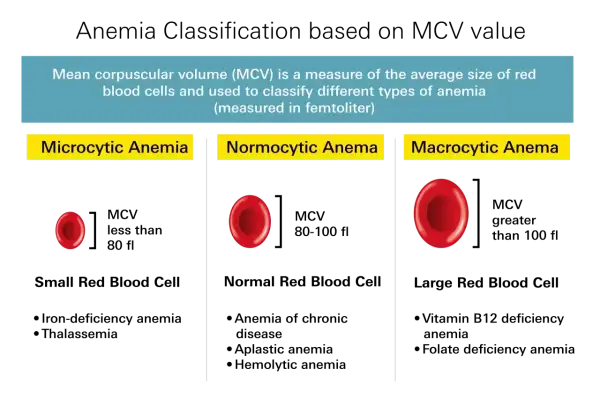 Porównanie wielkości erytrocytów: mikrocytarna anemia (małe), normocytarna (normalne), makrocytarna (duże). Niskie erytrocyty mogą oznaczać mikrocytarną anemię.