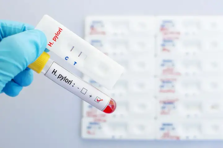 Ręka w niebieskiej rękawiczce trzyma probówkę z oznaczeniem "H. pylori: +" i test kasetkowy z dwoma paskami, wskazującymi pozytywny wynik helicobacter pylori badanie.